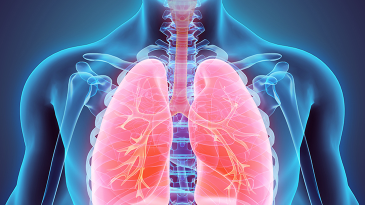 Akciğer Kanseri Nedir? Belirtileri Nelerdir? Tedavi Nasıl Yapılmaktadır?
